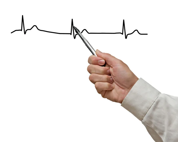 Zobrazeno EKG graf — Stock fotografie