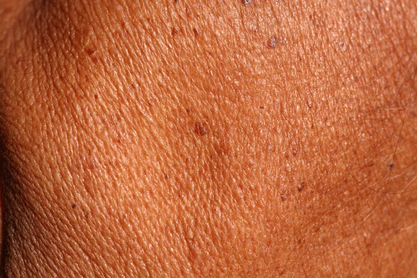 Skin Background. — Stock Photo, Image