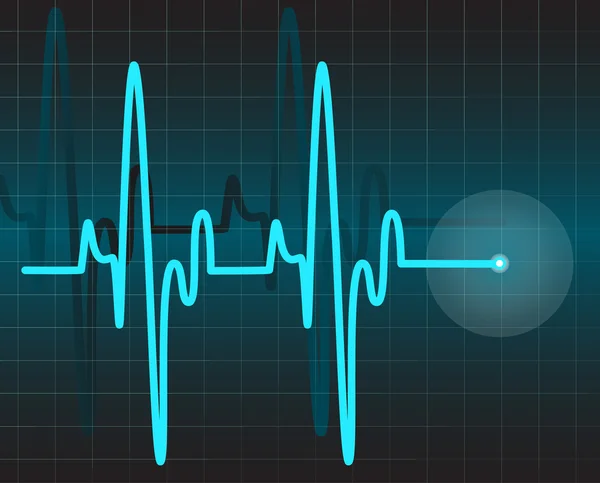 Eletrocardiograma — Vetor de Stock