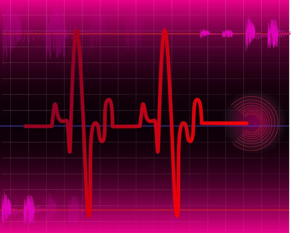 Elektrokardiogram — Wektor stockowy