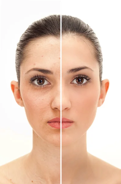 Schönheitskonzept vor und nach der Retusche — Stockfoto