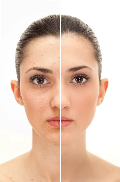 Conceito de beleza antes e depois do retoque Imagens De Bancos De Imagens