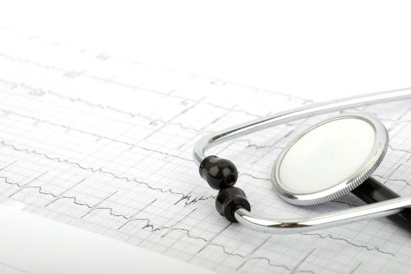 Stetoscopio sul cardiogramma — Foto Stock