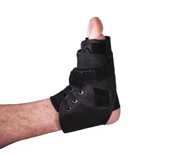 Cedera ankle dalam cast bertali — Stok Foto