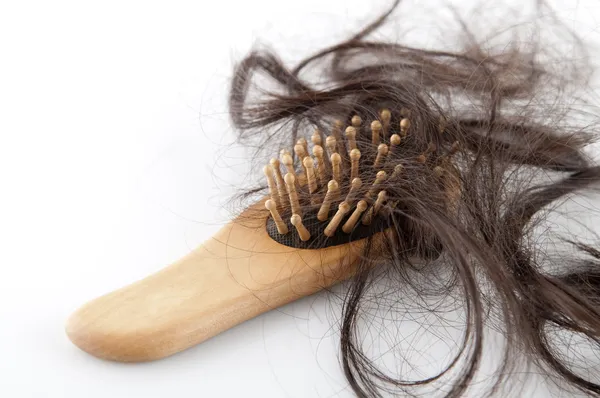 Випадання волосся — стокове фото