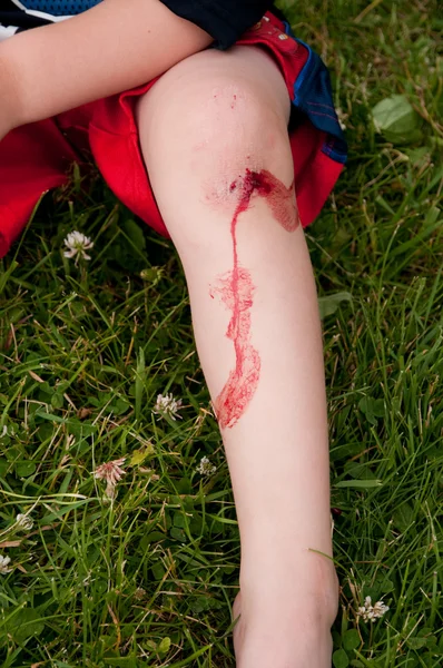 stock image Blood on leg