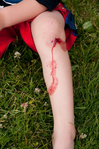다리에 혈액 로열티 프리 스톡 사진