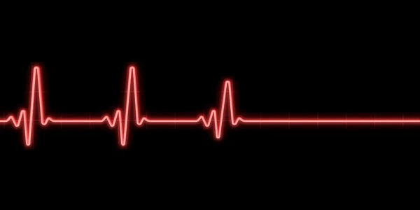 Batimento cardíaco no fundo preto — Fotografia de Stock