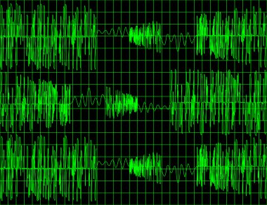 Abstract Audio Wave Form Background clipart