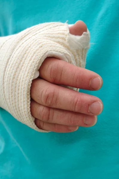 Mano y brazo lesionados — Foto de Stock