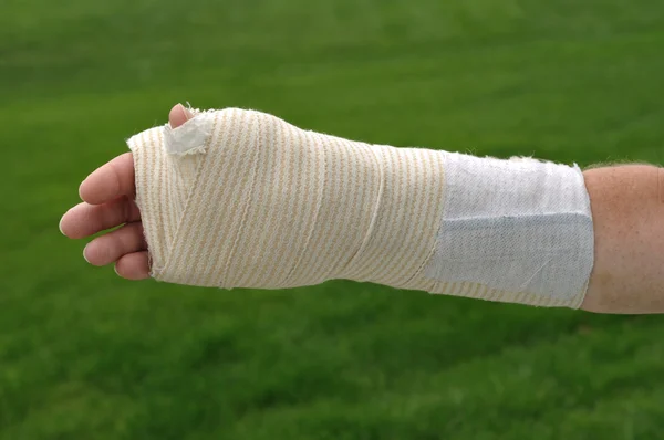 Mano y brazo lesionados — Foto de Stock