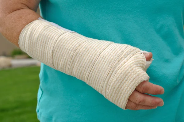 Skadade hand och arm — Stockfoto