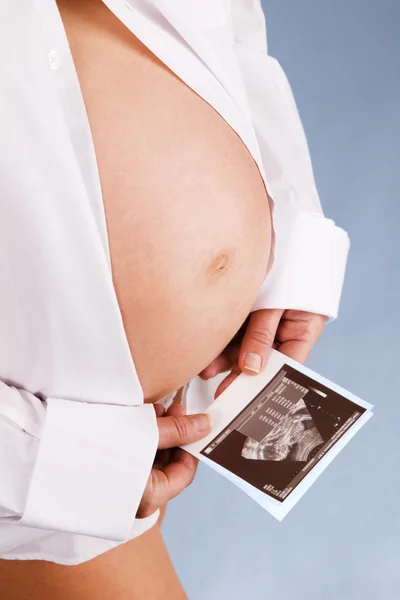 Mladá těhotná žena drží ultrazvukové testovací tisk — Stock fotografie