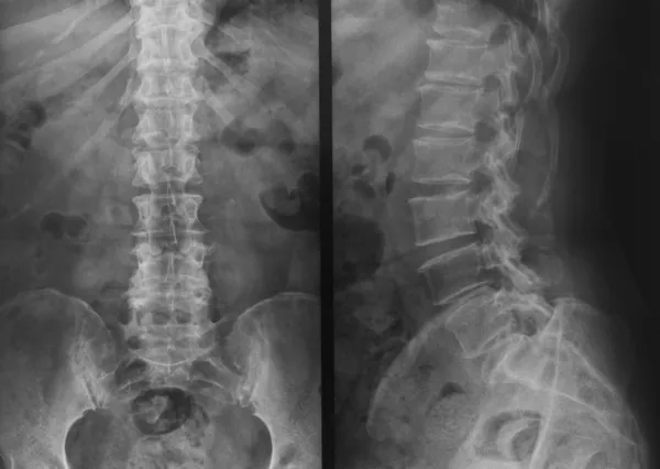 Рентген таза и позвоночника — стоковое фото