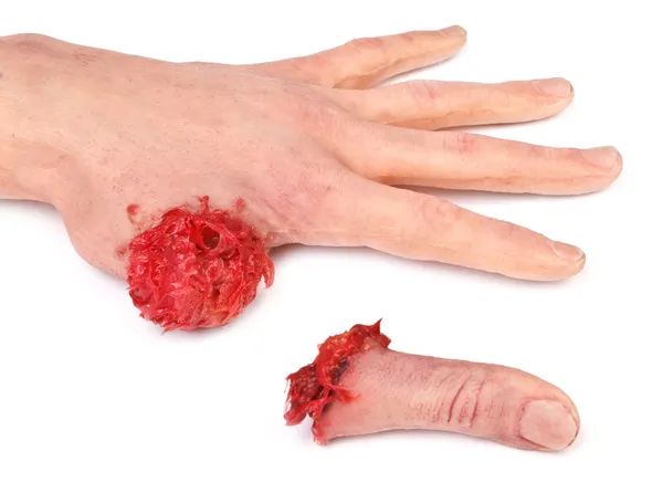 Искусственная человеческая рука с отрезанным пальцем — стоковое фото