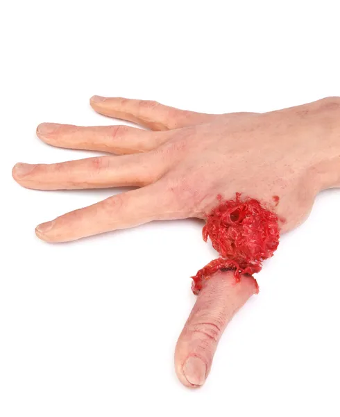 Artificiell mänsklig hand — Stockfoto