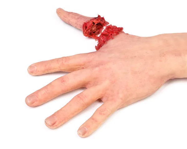 人工人类手的割手指 — 图库照片