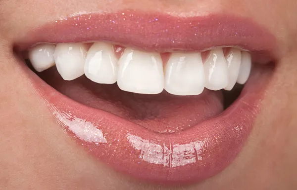 Красивые зубы Лицензионные Стоковые Фото