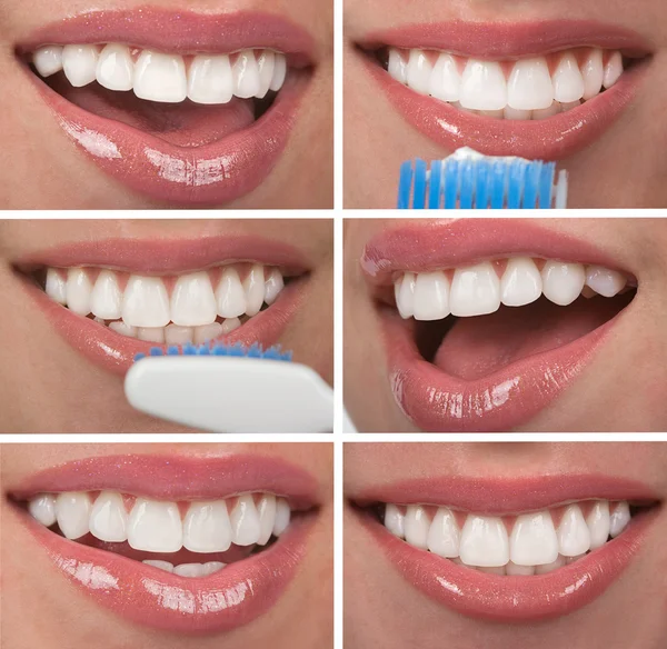 Dentes saudáveis — Fotografia de Stock
