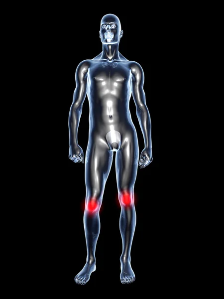 Ból kolana - anatomia — Zdjęcie stockowe
