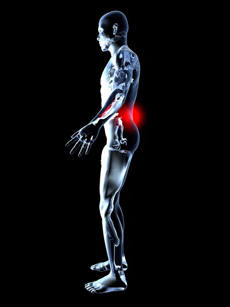 Dor nas costas - Anatomia — Fotografia de Stock