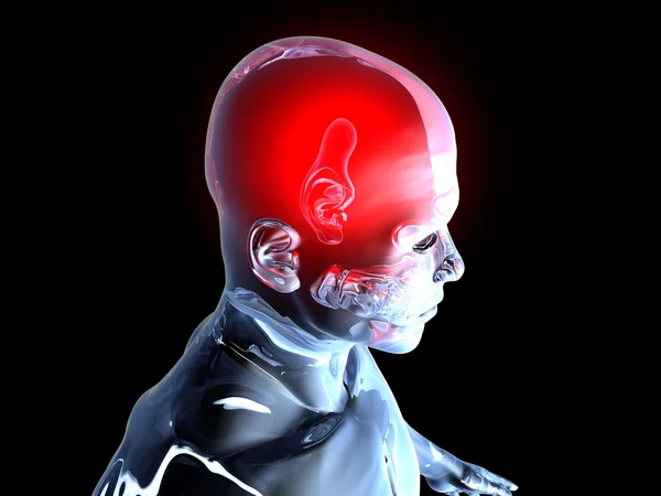 Bolest hlavy - anatomie — Stock fotografie