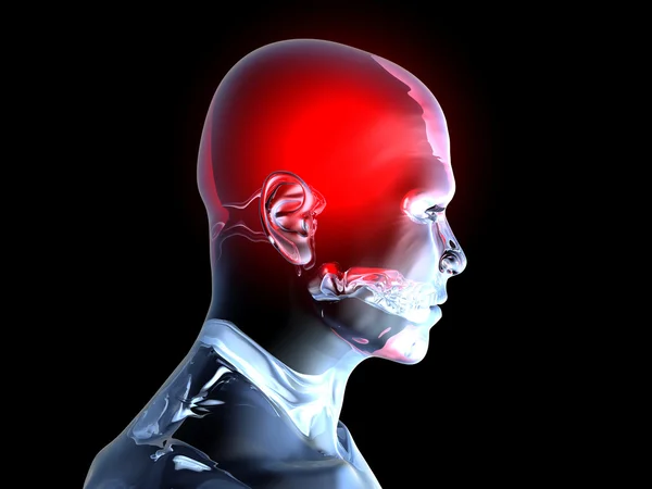 頭痛 - 解剖学 — ストック写真