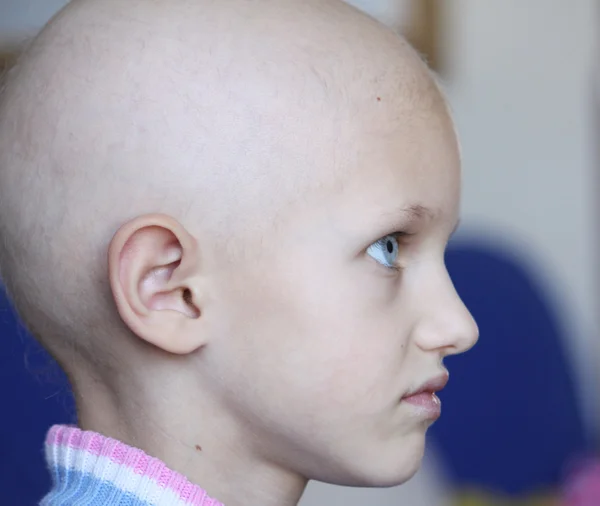 Профиль ребенка от рака — стоковое фото