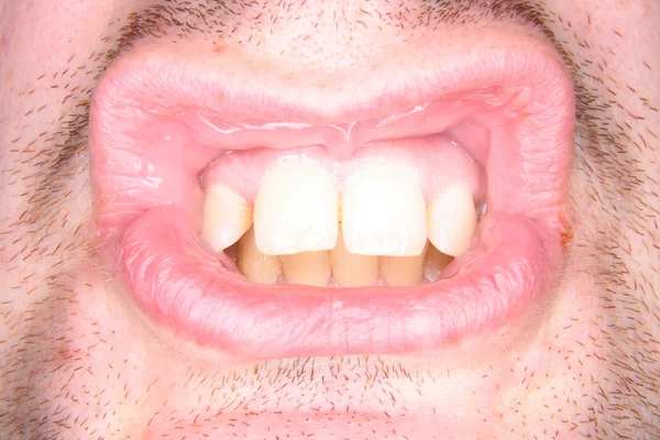 Зубы как фон — стоковое фото