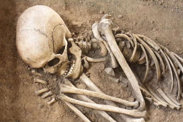 Человеческие кости — стоковое фото