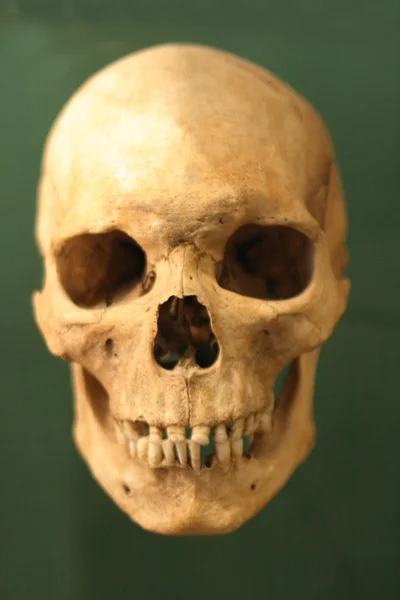 人間の頭蓋骨 — ストック写真