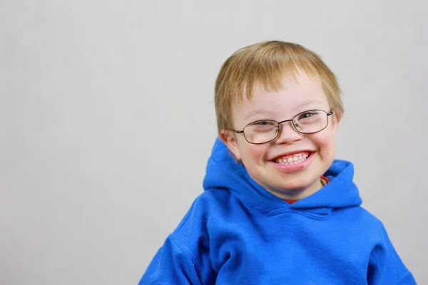 Niño con Síndrome de Downs y sonrisa muy feliz Fotos de stock