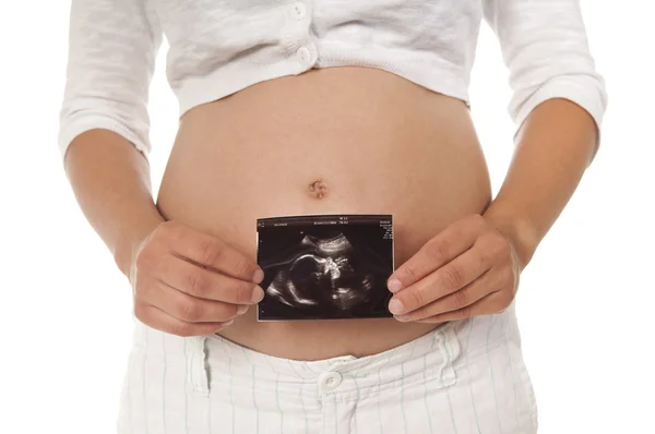 Беременная женщина с ультразвуковой картиной — стоковое фото
