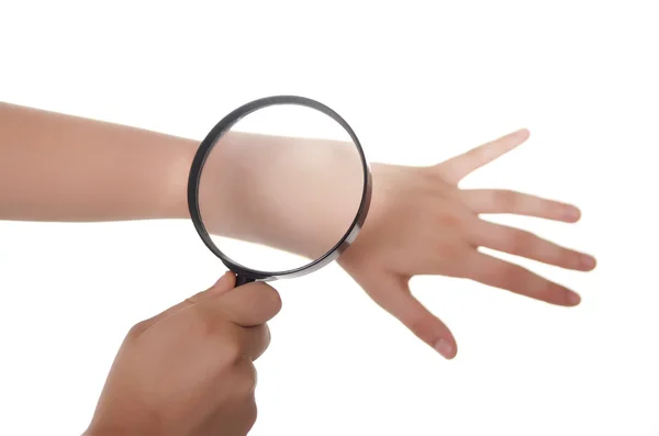 Hand, magnifying glass and skin — Stock Photo, Image