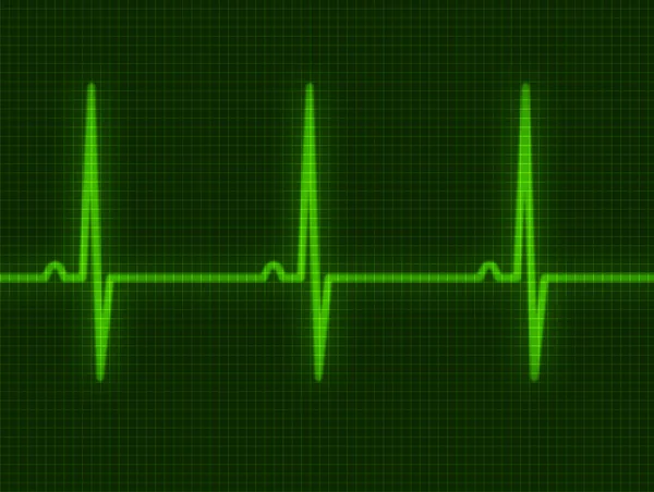 Cardiogram — Stockfoto