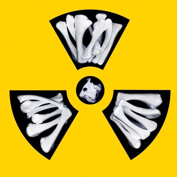 Radioactive bones — Stock Photo, Image