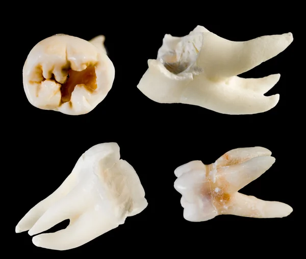 Zdalnego korzeń ludzki zęby — Zdjęcie stockowe