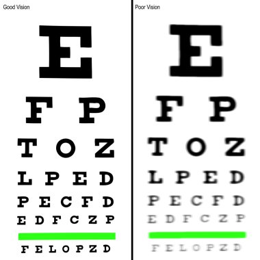 Good and Poor Eye Chart Illustrations. clipart