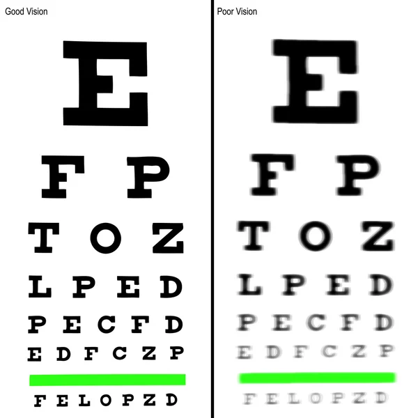 良いと貧しい人々 の視力検査表のイラスト. — ストック写真