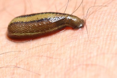 Leech for treatment clipart