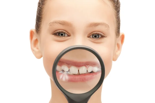 Tonårsflicka med förstoringsglas som visar tänderna — Stockfoto