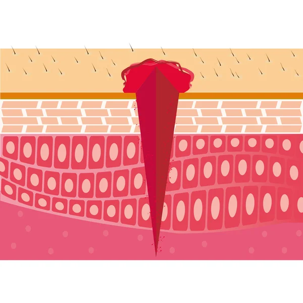 Анатомия поперечного сечения кожи — стоковое фото