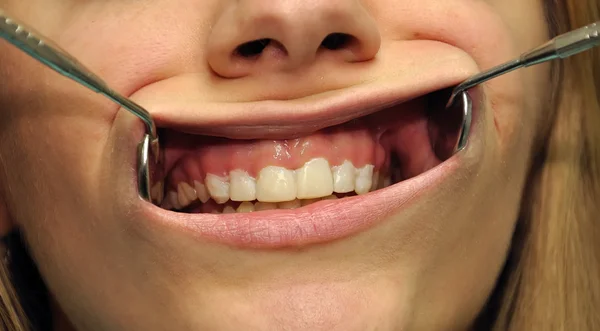 Hatta diş — Stok fotoğraf