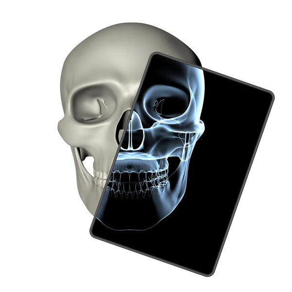 人类头骨-x 射线帧前视图 — 图库照片