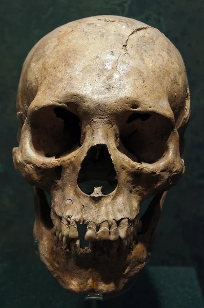 Людського черепа — стокове фото