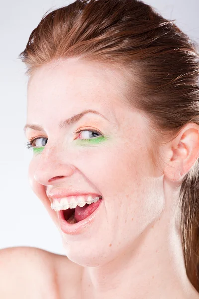 Smiling woman with braces on teeth — Stock Photo, Image