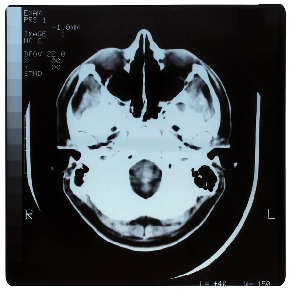 Radiographie médicale — Photo