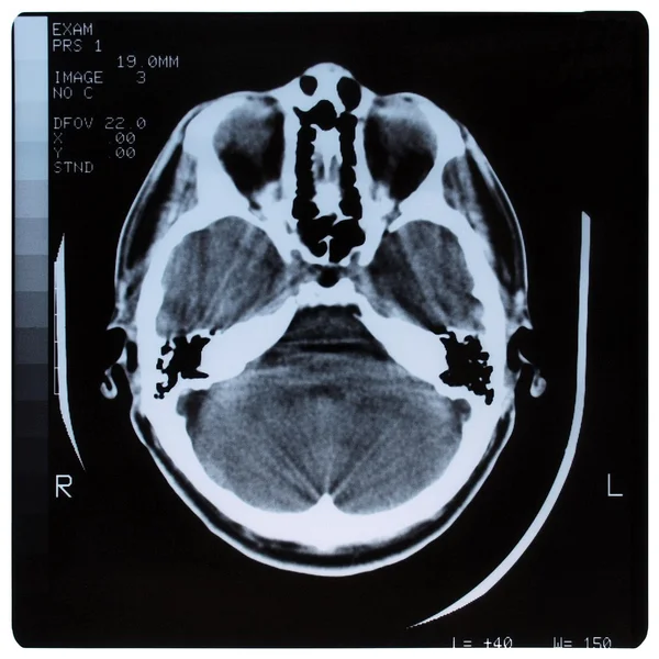 Radiografía médica —  Fotos de Stock