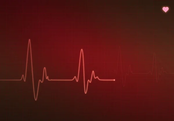 Critical Heart Condition — Stock Photo, Image