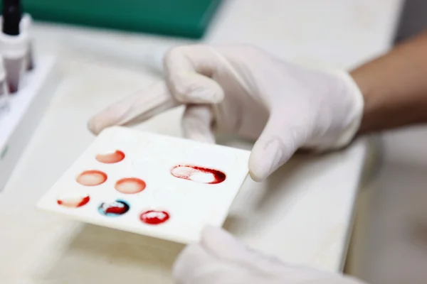 血液测试 — 图库照片